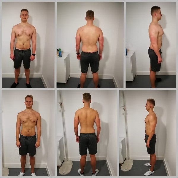 Simple Ways Office Workers Can Improve Posture and Reduce Daily Discomfort