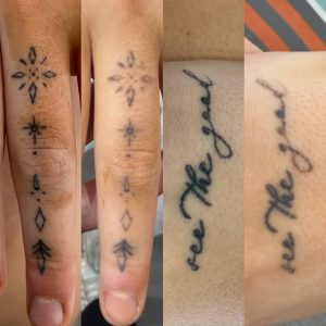 Tattoo removals